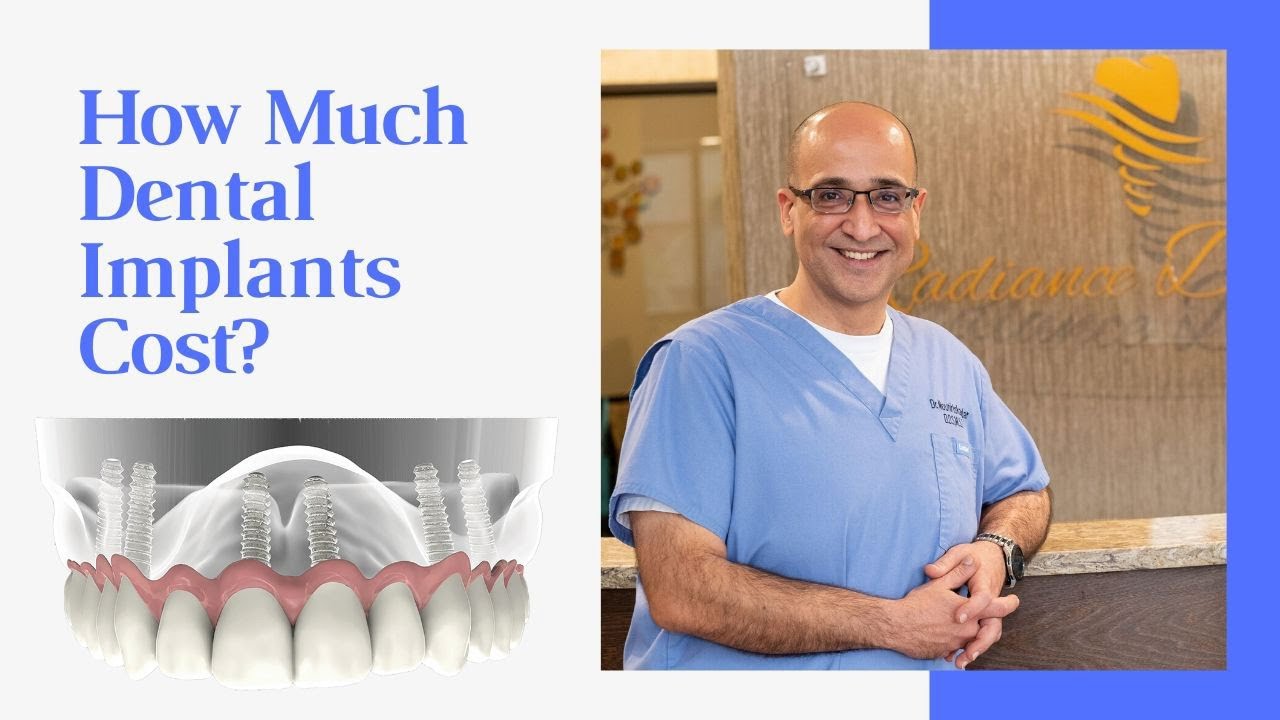 How much dental implants cost? Dental Clinic