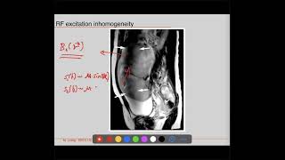 EE225E Sp21 Principles of MRI Lecture 19