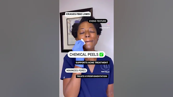 Unlock Flawless Skin with this Shocking Chemical Peel Hack! #shorts