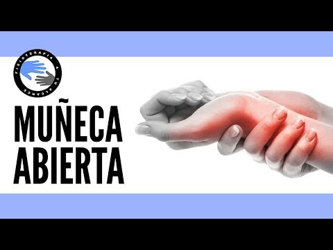 Vídeo: Tendovaginitis De La Articulación De La Muñeca (manos): Causas, Síntomas Y Tratamiento
