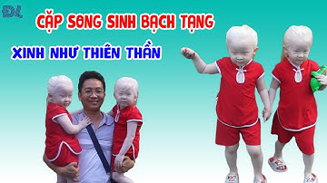Phát hiện ở Việt Nam có cặp song sinh thiên thần - ĐỘC LẠ BÌNH DƯƠNG