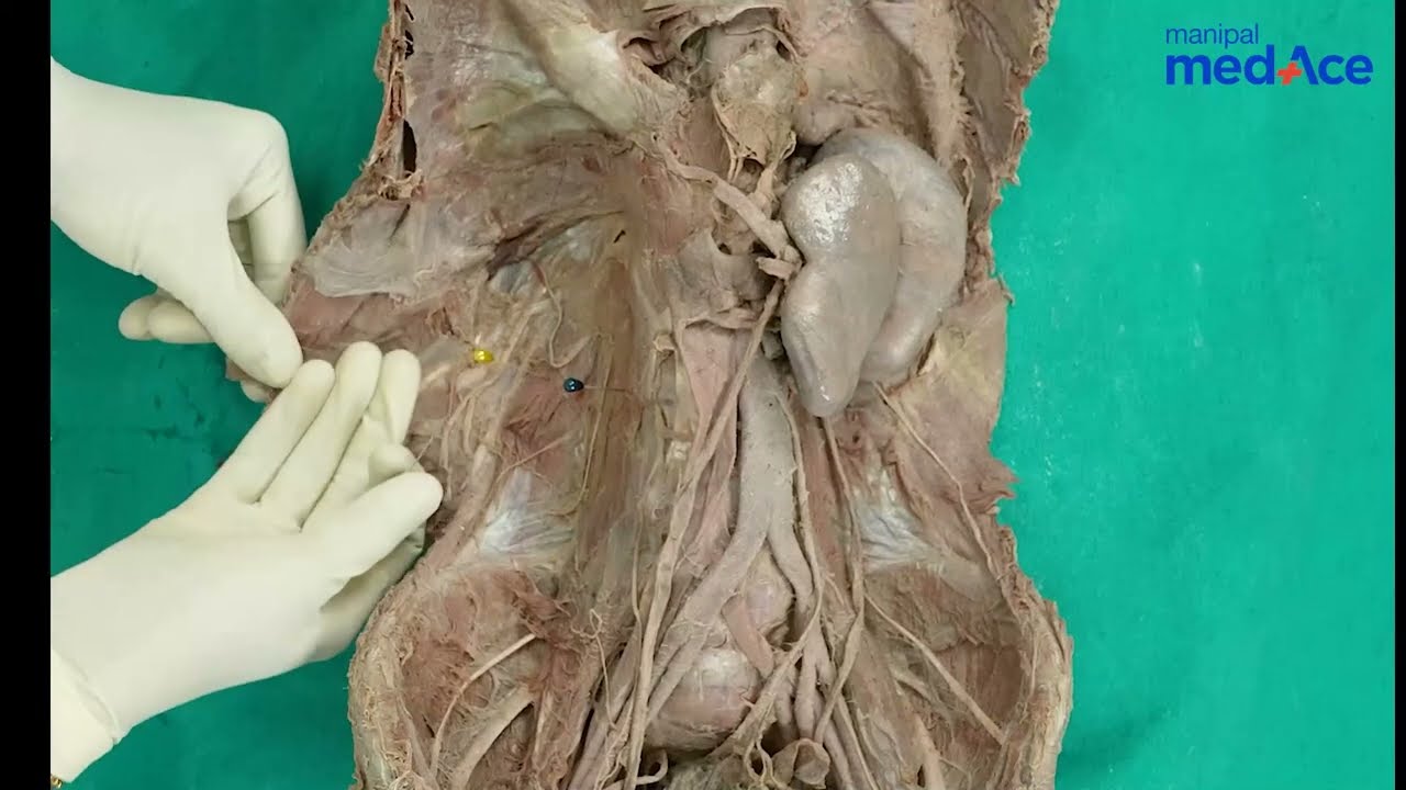 Dissection of Kidneys