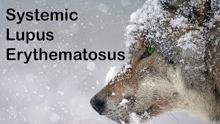 Systemic lupus erythematosus by Internal Medicine 4,050 views 5 years ago 14 minutes, 28 seconds