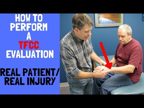 How to Perform a TFCC Evaluation:Real patient, real injury!