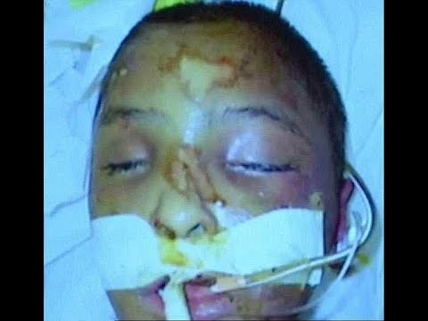 Video: The Autopsy Of The Boy Gabriel
