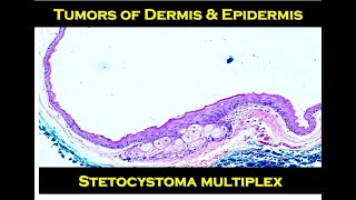 8g - Stetocystoma multiplex screenshot 5