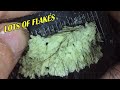 BIG FLAKES! Dandruff combing #123