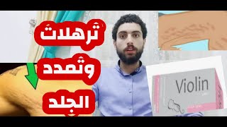 التخلص من علامات تمدد الجلد والسوليليت في وقت قياسي