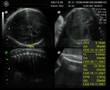 May 20070922