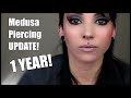 Medusa Piercing UPDATE! | 1 YEAR | Very In-Depth