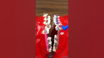 Hướng dẫn vệ sinh răng niềng bằng bàn chải kẽ  #niềngrăng #dentist #niengrang #orthodontist