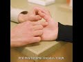 Arthrithis of Thumb-Hands, Causes, and Non Surgical Advanced Treatments