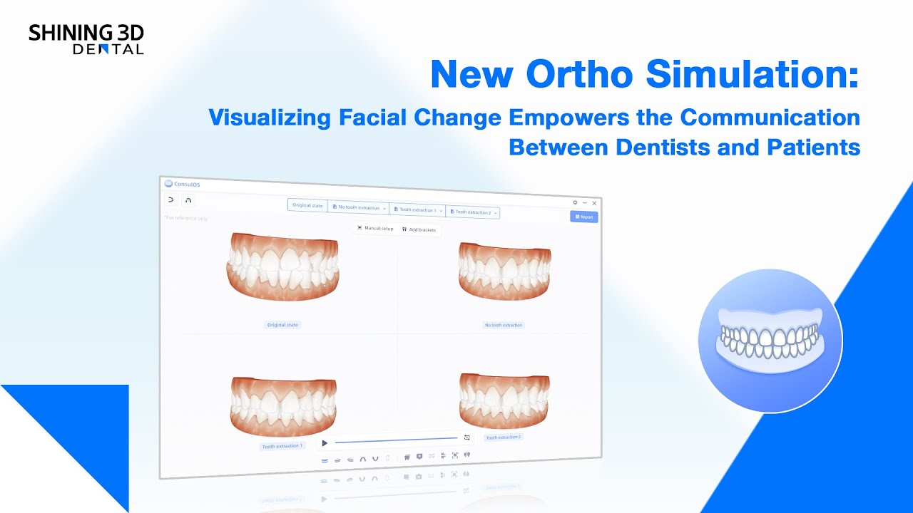 New Ortho Simulation enhances dentist-patient communication through ...
