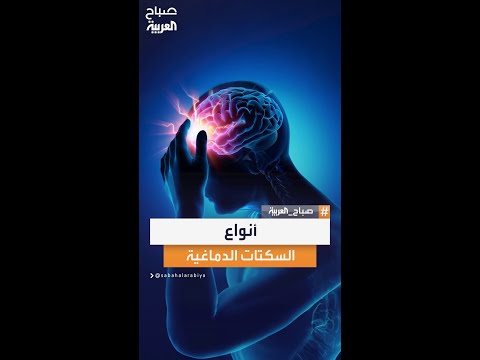 اختصاصي المخ والأعصاب عبد الرحمن الشمري من مستشفى الموسى التخصصي يشرح أنواع السكتات الدماغية