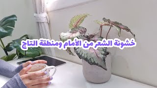 أسباب خشونة المنطقة الأمامية و التاج للشعر | علاقة الهرمونات + حلول