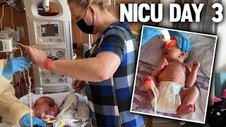 nicu day 3 dealing with chloes hyperbilirubinemia health scares