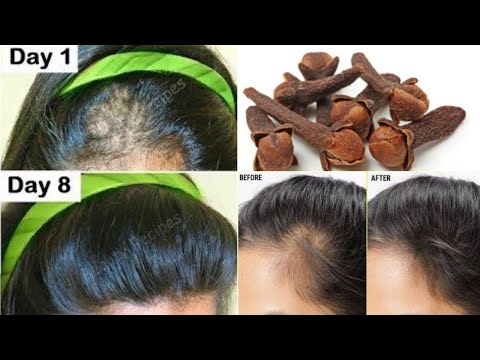 Индийский секрет,  🌱молниеносно отрастить волосы и лечить облысение в первую неделю