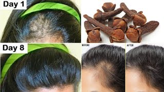 the Indian secret, 🌿 to grow hair at a rocket speed and treat baldness from the first week