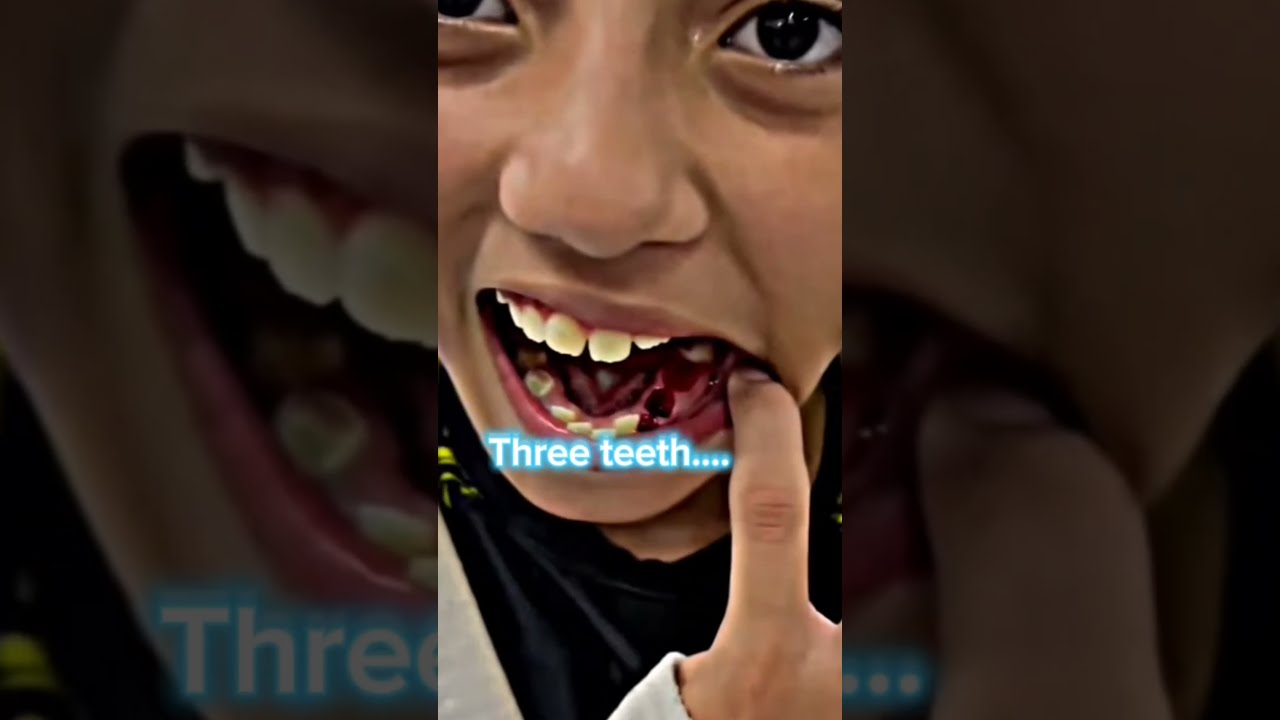 Boxer Troll Trollface Edit Editing Short Virashort Shortvideos Trollfacecoolmomentscompi