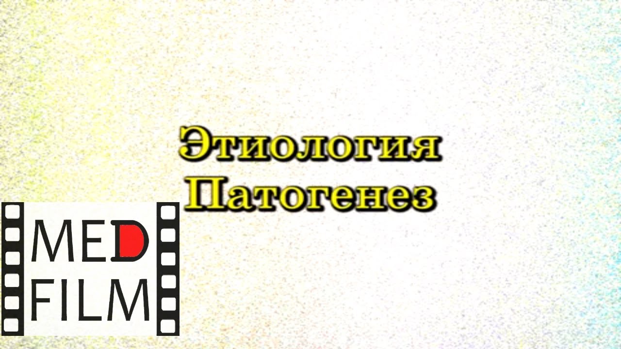 Этиология, патогенез "синдрома Кавасаки" у детей © The pathogenesis of Kawasaki Syndrome"