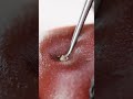 Super satisfying blackhead removal!☝️ Model: @frenchiesmodels  Beautician: @estheticskinexpert