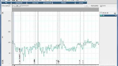 Automatically find a point and select Data in LabChart