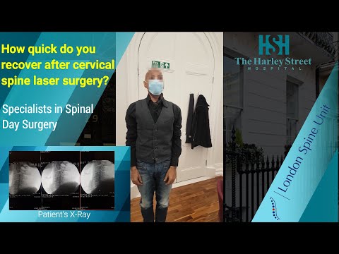 How quick do you recover after cervical spine laser surgery? ( London Spine Unit )