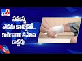Hospital amputates wrong leg of elderly man