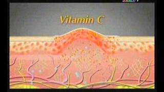 Download lagu 07 15 13 DERMATIX Dimming Scar Cream DERMATIX ULTRA 30s TVC Archives