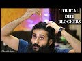 Hair Loss Kaise Kam Kare - Best Topical DHT Blockers | Bearded Chokra