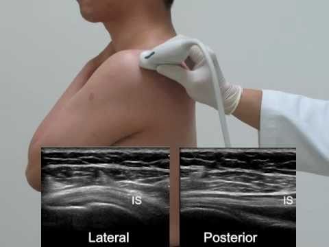 US-guided exam and injection of the shoulder _0516 Final.flv - YouTube