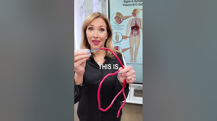 Scary Warning Sign of a Vitamin B12 Deficiency #shorts