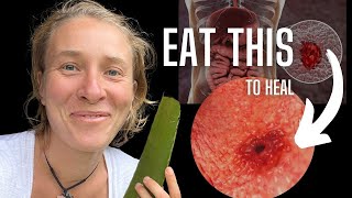 Eat These 4 Foods And Heal Your Stomach ULCER Fast screenshot 3