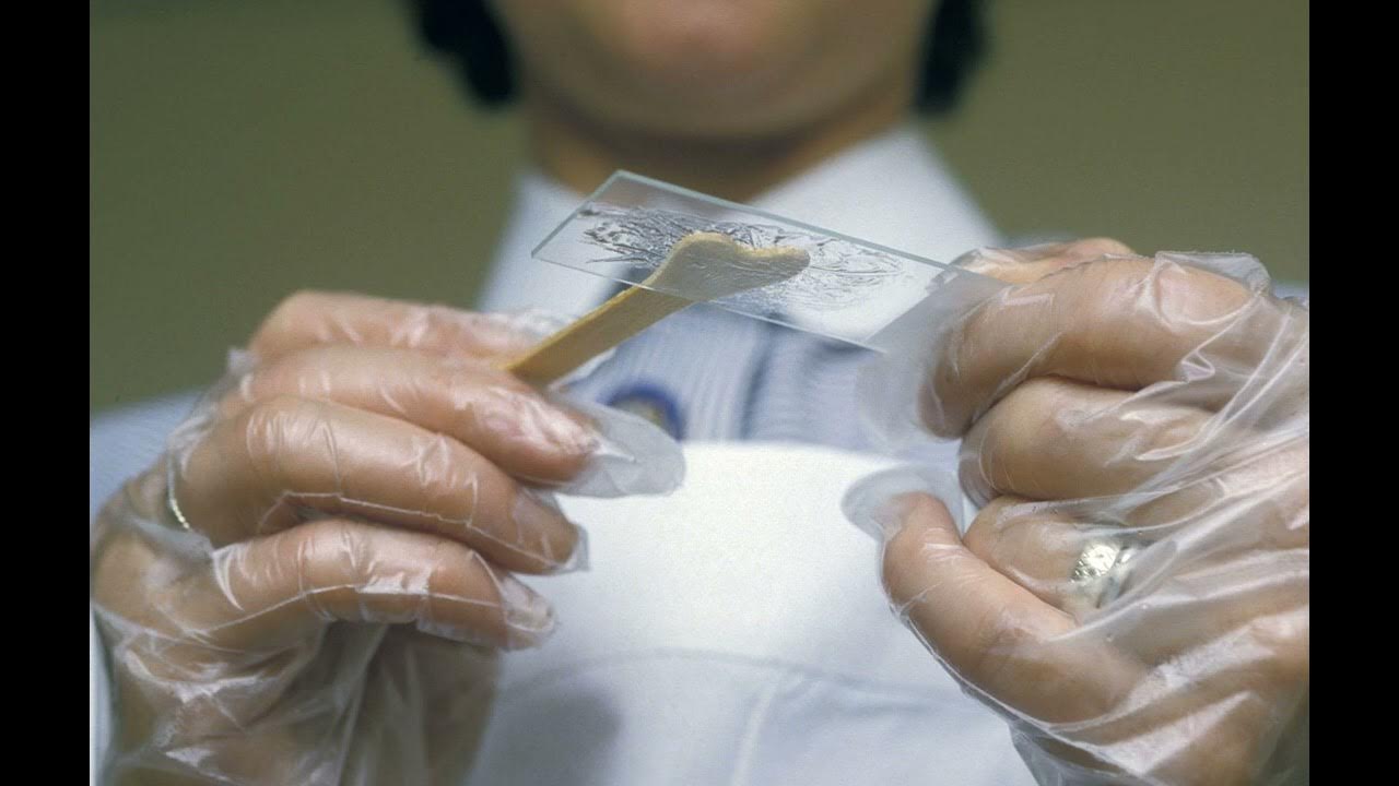 How to Prepare for a Pap Smear YouTube