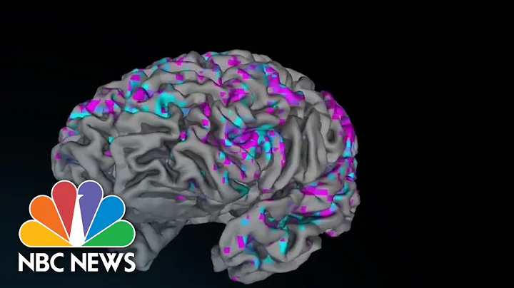 Artificial intelligence study decodes brain activity into diaglogue - DayDayNews