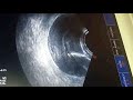 DR Rammah د احمد رماح Transmyometrial Embryo Transfer DR Rammah د احمد رماح Transmyometrial Embryo Transfer
