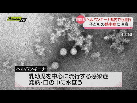 【夏風邪ヘルパンギーナ流行】子どもの熱中症に注意！ 口内の痛みで水分がとりづらい場合も…（静岡県）