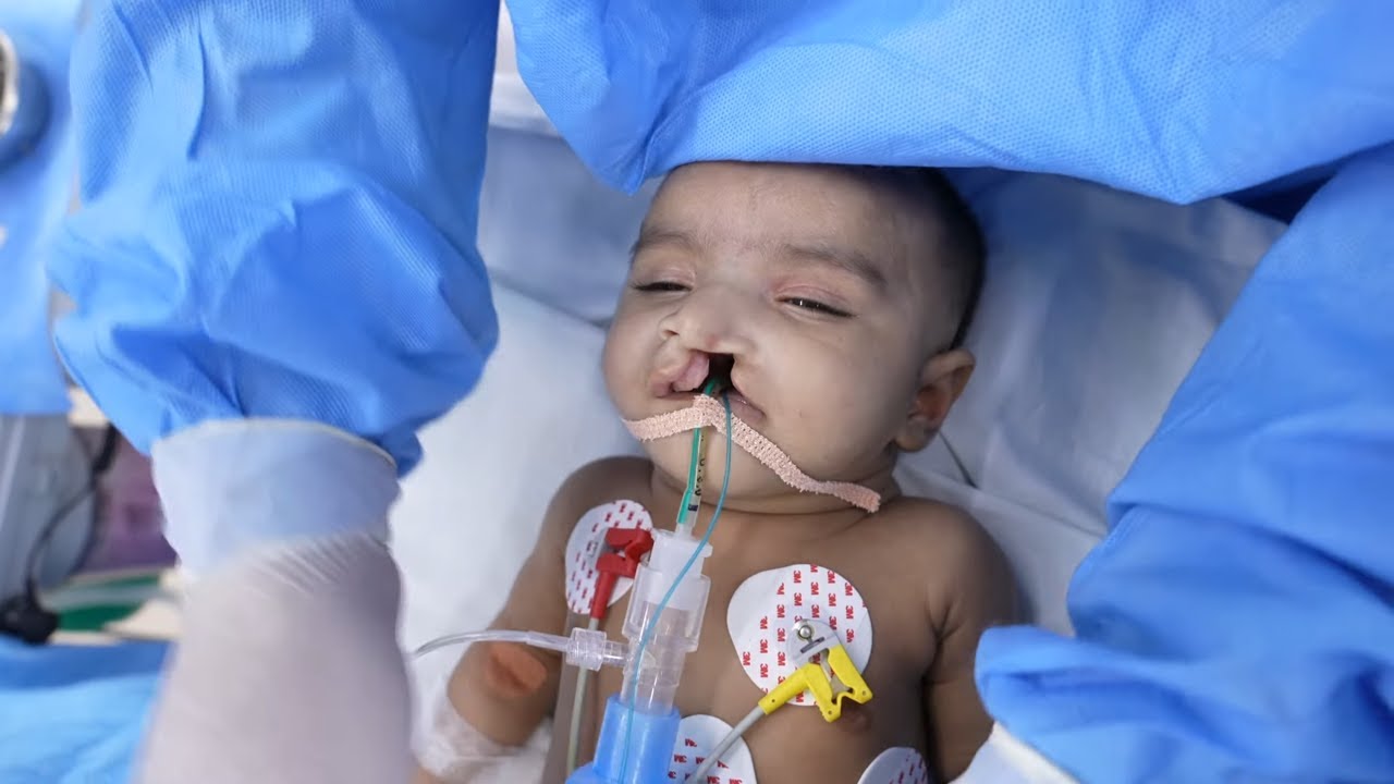 Small Baby Painless Anesthesia Sleeping YouTube