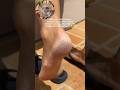Get rid of cracked heels | Fix cracked heels at home #heels #CrackedHeels #ridofcrackedheels #shorts