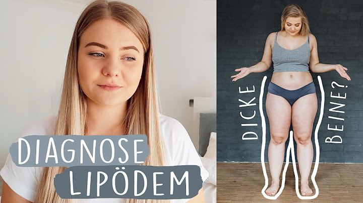 Deshalb sind meine Beine so "dick" | Meine Lipödem Geschichte