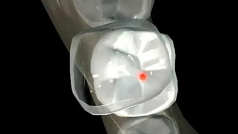 DYNAMIC OCCLUSION   MANDIBLE