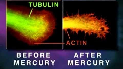 How Mercury Causes Brain Neuron Degeneration - University Of Calgary