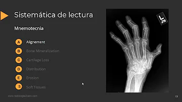 ¿La artritis aparece en las radiografías?