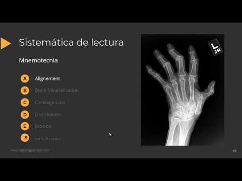 Vídeo: ¿Por Qué La Radiografía Ya No Debe Considerarse Una Medida De Resultado Sustituta Para La Evaluación Longitudinal Del Cartílago En La Osteoartritis De Rodilla?