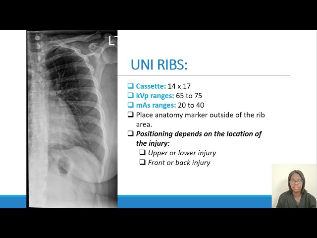 Ribs Labeled Chest X Ray