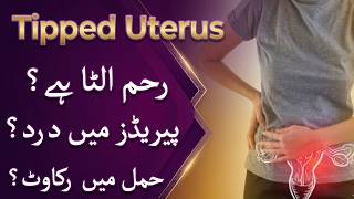 Tipped Uterus Kya Hai? | Pregnancy Aur Periods Par Asar Urdu Mein