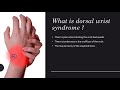 Dorsal Wrist Syndrome - Everything You Wanted to Know