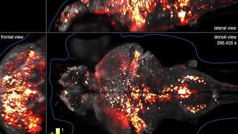 Time-Lapse: Zebrafish Neural Activity by Dr. Phillip Keller