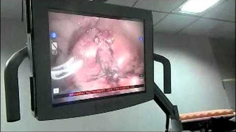 da vinci robotic surgery training for surgeon and gynecologists