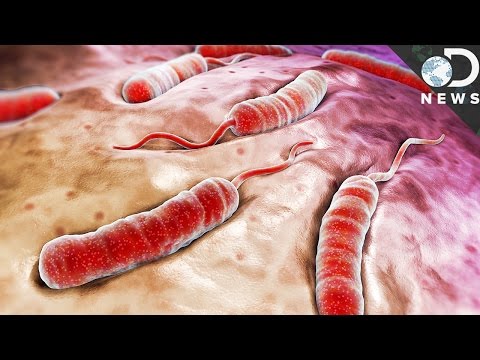 What Exactly Does Cholera Do To Your Body?